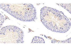 Detection of CTSS in Mouse Testis Tissue using Polyclonal Antibody to Cathepsin S (CTSS) (Cathepsin S Antikörper  (AA 123-339))