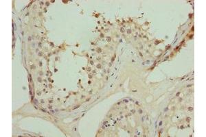 Immunohistochemistry of paraffin-embedded human testis tissue using ABIN7162475 at dilution of 1:100 (TRIP13 Antikörper  (AA 181-390))