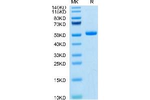 Mouse TLT-1 on Tris-Bis PAGE under reduced condition. (TREML1 Protein (AA 21-175) (Fc Tag))