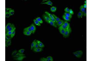 Immunofluorescence staining of HepG2 cells with ABIN7170156 at 1:100, counter-stained with DAPI. (SLC22A25 Antikörper  (AA 31-145))