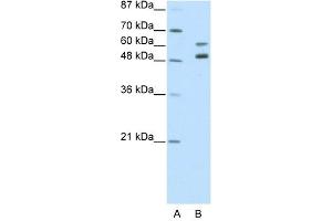 Western Blot showing ZNF682 antibody used at a concentration of 1-2 ug/ml to detect its target protein. (ZNF682 Antikörper  (N-Term))