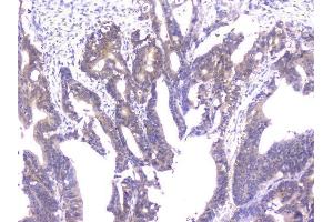 IHC analysis of PPID using anti-PPID antibody (ABIN6719438).
