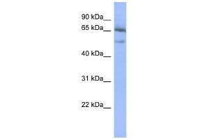 WB Suggested Anti-NFKBIE Antibody Titration:  0. (NFKBIE Antikörper  (Middle Region))
