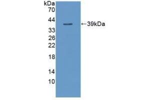 Detection of Recombinant TNFaIP3, Human using Polyclonal Antibody to Tumor Necrosis Factor Alpha Induced Protein 3 (TNFaIP3) (TNFAIP3 Antikörper  (AA 1-300))