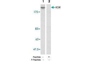 Western blot analysis of extract from SK-OV-3 cells using KDR polyclonal antibody  . (VEGFR2/CD309 Antikörper)
