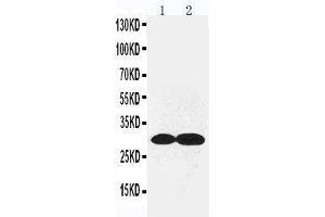 Anti-Collagen IV antibody, Western blotting Lane 1: Rat Kidney Tissue Lysate Lane 2: Rat Lung Tissue Lysate (COL4a2 Antikörper  (C-Term))