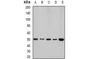 Western blot analysis of NFS1 expression in HepG2 (A), SKOV3 (B), mouse kidney (C), mouse heart (D), rat liver (E) whole cell lysates. (NFS1 Antikörper)