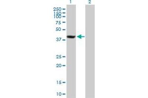 Western Blot analysis of SDCCAG8 expression in transfected 293T cell line by SDCCAG8 MaxPab polyclonal antibody. (SDCCAG8 Antikörper  (AA 1-360))