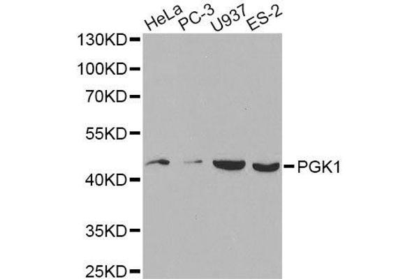 PGK1 抗体  (AA 1-417)