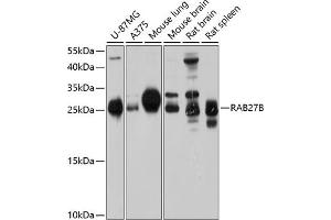 Western blot analysis of extracts of various cell lines, using RB antibody (ABIN6132610, ABIN6146565, ABIN6146566 and ABIN6214629) at 1:1000 dilution. (RAB27B Antikörper  (AA 1-218))
