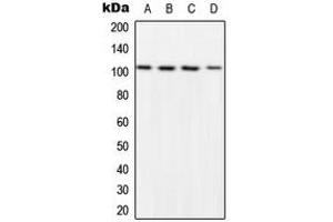 Western Blotting (WB) image for anti-Nuclear Factor of kappa Light Polypeptide Gene Enhancer in B-Cells 1 (NFKB1) (C-Term), (pSer932) antibody (ABIN7299380)