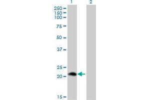 Western Blot analysis of PLA2G12A expression in transfected 293T cell line by PLA2G12A monoclonal antibody (M01), clone 1D11. (PLA2G12A Antikörper  (AA 90-188))