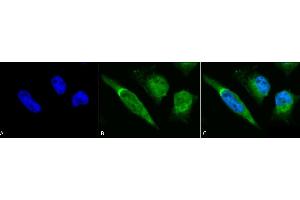 Immunocytochemistry/Immunofluorescence analysis using Rabbit Anti-GRP78 Polyclonal Antibody (ABIN361824 and ABIN361825).