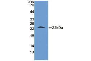 Western blot analysis of recombinant Human STIP1. (STIP1 Antikörper  (AA 1-169))