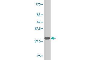 Western Blot detection against Immunogen (35. (NKX6-1 Antikörper  (AA 191-275))