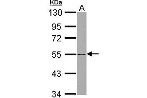 Western Blotting (WB) image for anti-SH3-Domain Binding Protein 5 (SH3BP5) (AA 193-455) antibody (ABIN1500917) (SH3BP5 Antikörper  (AA 193-455))