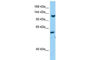 WB Suggested Anti-TLL1 Antibody Titration: 1. (TLL1 Antikörper  (C-Term))