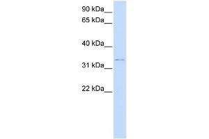 WB Suggested Anti-DCN Antibody Titration:  0. (Decorin Antikörper  (N-Term))
