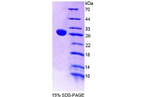 SDS-PAGE analysis of Human NT5C2 Protein. (NT5C2 Protein)