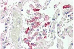 Human Lung (formalin-fixed, paraffin-embedded) stained with CES1 antibody ABIN337128 at 2. (CES1 Antikörper  (AA 533-544))