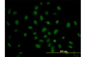 Immunofluorescence of monoclonal antibody to PRKAA1 on HeLa cell. (PRKAA1 Antikörper  (AA 451-550))