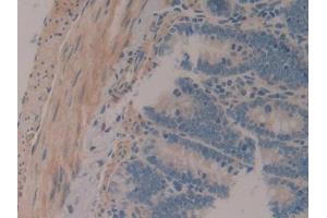 IHC-P analysis of Rat Intestine Tissue, with DAB staining. (MAP1A Antikörper  (AA 2110-2367))