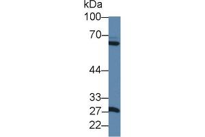 Western Blot; Sample: Rat Pancreas lysate; ;Primary Ab: 1µg/ml Rabbit Anti-Rat MMP1 Antibody;Second Ab: 0.