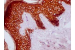 IHC image of ABIN7180977 diluted at 1:100 and staining in paraffin-embedded human skin tissue performed on a Leica BondTM system. (KRT14/KRT16/KRT5/KRT6A/KRT8 Antikörper)