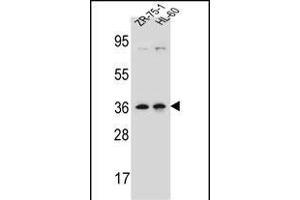 LUZP2 Antibody (N-term) (ABIN657098 and ABIN2837894) western blot analysis in ZR-75-1,HL-60 cell line lysates (35 μg/lane).