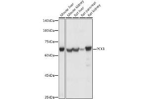 Western blot analysis of extracts of various cell lines, using PCK1 antibody (ABIN3022753, ABIN3022754, ABIN3022755 and ABIN6219210) at 1:1000 dilution. (PCK1 Antikörper  (C-Term))