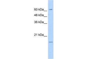 Western Blotting (WB) image for anti-Solute Carrier Family 13 Member 3 (SLC13A3) antibody (ABIN2462408) (SLC13A3 Antikörper)