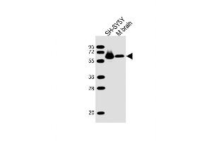Lane 1: SH-SY5Y, Lane 2: mouse brain lysate at 20 µg per lane, probed with bsm-51444M DPYSL5 (1503CT789. (DPYSL5 Antikörper)