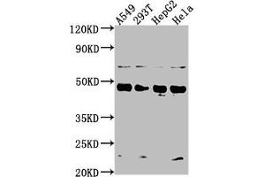 Western Blot Positive WB detected in: A549 whole cell lysate, 293T whole cell lysate, HepG2 whole cell lysate, Hela whole cell lysate All lanes: SNX5 antibody at 1:2000 Secondary Goat polyclonal to rabbit IgG at 1/50000 dilution Predicted band size: 47, 14 kDa Observed band size: 47 kDa (SNX5 Antikörper  (AA 7-245))
