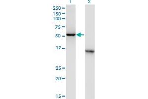 Western Blot analysis of NXF3 expression in transfected 293T cell line by NXF3 monoclonal antibody (M02), clone 2C7. (NXF3 Antikörper  (AA 1-100))