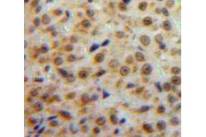 Used in DAB staining on fromalin fixed paraffin-embedded Ovary tissue (ESR2 Antikörper  (AA 149-213))