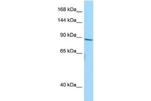 Western Blotting (WB) image for anti-Neuroblastoma Breakpoint Family, Member 10 (NBPF10) (C-Term) antibody (ABIN2790662) (NBPF10 Antikörper  (C-Term))