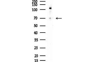 Western blot analysis of lysates from COLO205 cells, using DCP1A Antibody at 1/1000 dilution.