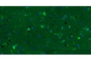 Immunohistochemistry (Paraffin-embedded Sections) (IHC (p)) image for anti-G Protein-Coupled Receptor 15 (GPR15) (AA 51-150) antibody (AbBy Fluor® 488) (ABIN899508)