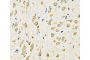 Immunohistochemistry of paraffin-embedded Mouse brain using PTPRE Polyclonal Antibody at dilution of 1:100 (40x lens). (PTPRE Antikörper)