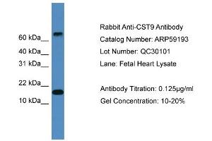 WB Suggested Anti-CST9  Antibody Titration: 0. (CST9 Antikörper  (Middle Region))