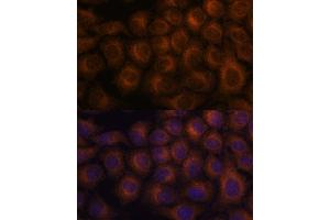 Immunofluorescence analysis of HeLa cells using V antibody  at dilution of 1:100. (VAV3 Antikörper  (AA 560-680))