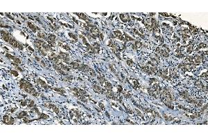 IHC analysis of CDC45L using anti-CDC45L antibody (ABIN7600230). (CDC45 Antikörper  (AA 166-431))