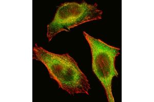 Fluorescent image of Hela cell stained with TEC Antibody (Center) (ABIN392111 and ABIN2841862). (NR4A3 Antikörper  (AA 175-205))