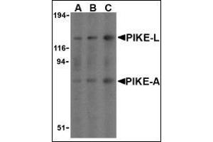 Western Blotting (WB) image for anti-ArfGAP with GTPase Domain, Ankyrin Repeat and PH Domain 2 (AGAP2) (C-Term) antibody (ABIN500501)