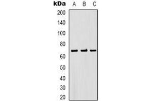 Western blot analysis of Bestrophin-1 expression in PC3 (A), mouse brain (B), rat brain (C) whole cell lysates.