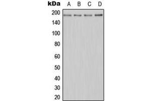 Western blot analysis of MERTK expression in Jurkat (A), HeLa (B), Raw264. (MERTK Antikörper  (N-Term))