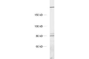 dilution: 1 : 1000, sample: crude synaptosomal fraction of rat brain (P2) (ITPR1 Antikörper)