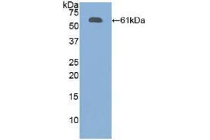 Western blot analysis of recombinant Human FBN1. (Fibrillin 1 Antikörper  (AA 449-711))