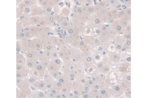 DAB staining on IHC-P;Samples:Human Liver Tissue.