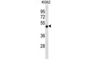 Western Blotting (WB) image for anti-Coiled-Coil Domain Containing 6 (CCDC6) antibody (ABIN3000929) (CCDC6 Antikörper)